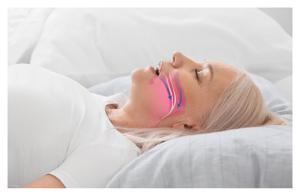 Snoring Treatment in Abu Dhabi: Sleep Peacefully Again