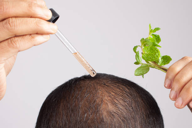 PRP Hair Treatment in Islamabad: A Revolutionary Solution for Hair Loss