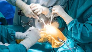 Comprehensive Guide to Knee Replacement Surgery: Process and Recovery