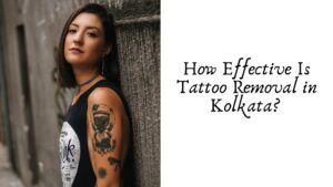 How Effective Is Tattoo Removal in Kolkata?