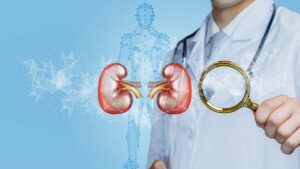 How to Diagnose Polycystic Kidney Disease